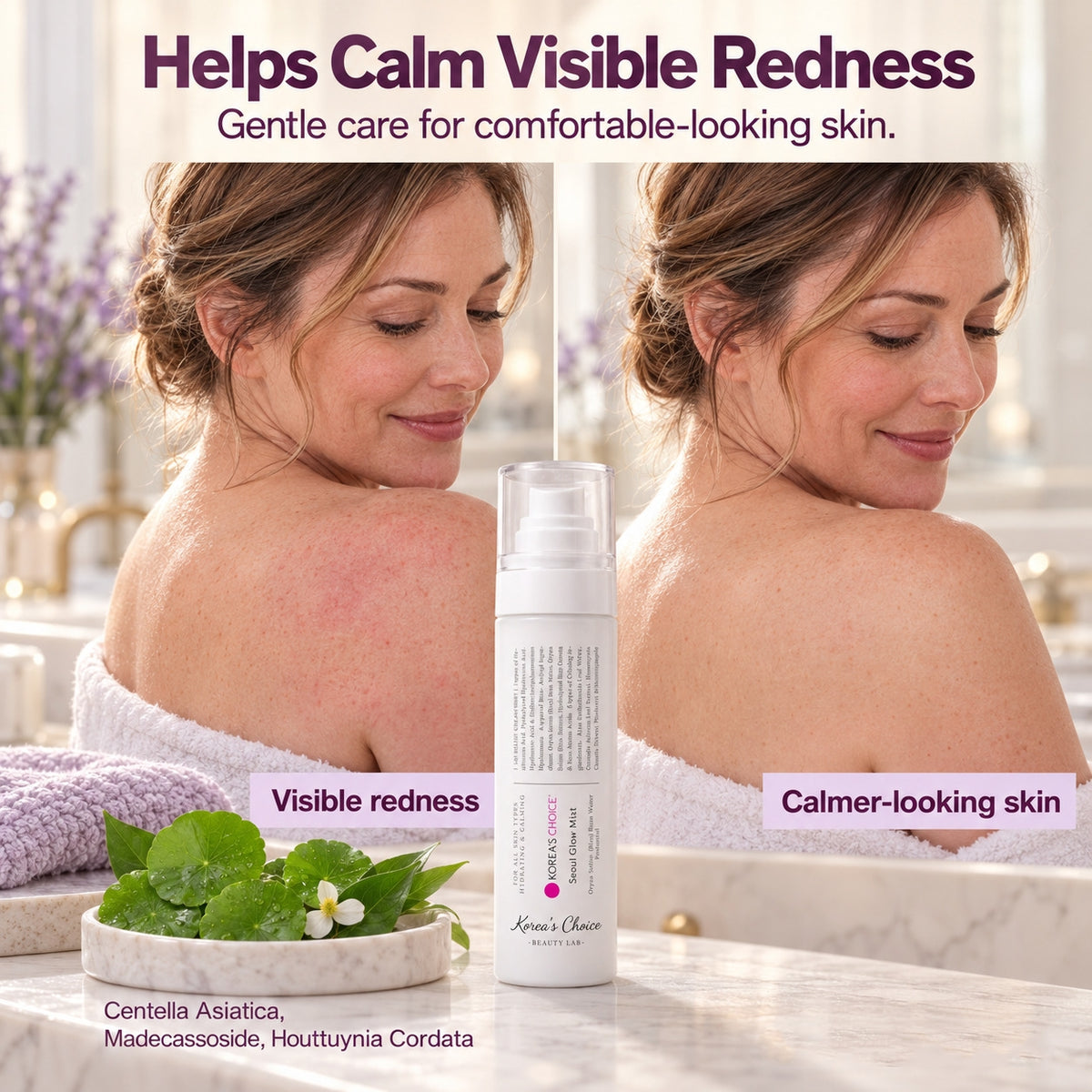 Fast-Acting Acne Spray ✨ Targeted Acne Care for Clearer-Looking Skin in Just 7 Days