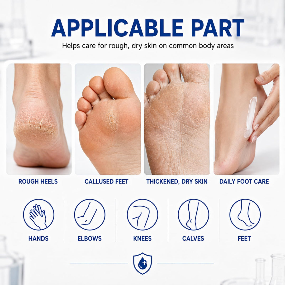 40 Percent Urea Cream Hand Foot Cream for Dry Cracked Skin