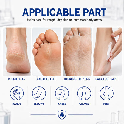 40 Percent Urea Cream Hand Foot Cream for Dry Cracked Skin