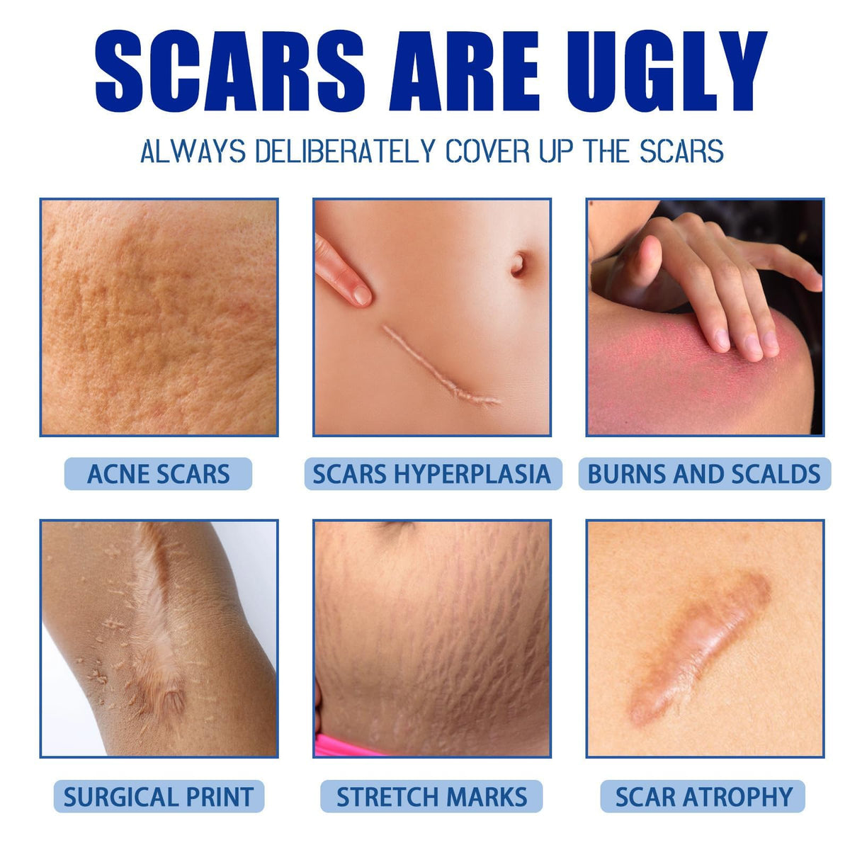 Scar Removal Cream Silicone Scar Gel Daily Care for Smoother-Looking Skin