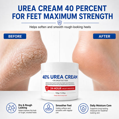 40 Percent Urea Cream Hand Foot Cream for Dry Cracked Skin